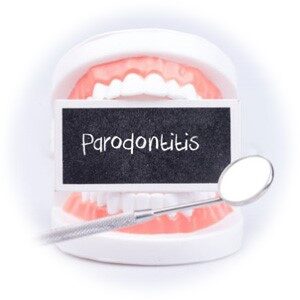 Parodontose Behandlung