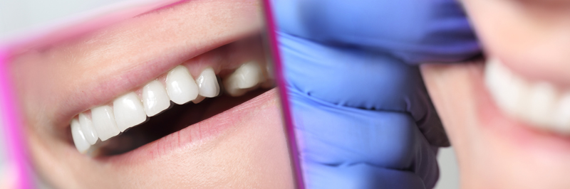ERGO Sofort Zahnzusatzversicherung für laufende Behandlungen