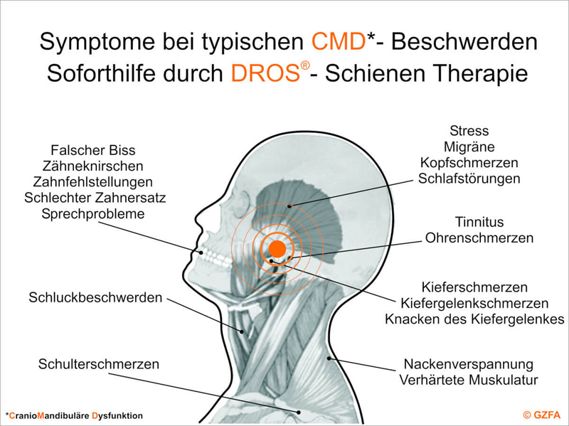 Symptome bei CMD Beschwerden